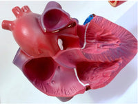 Modelo de corazon trombosis Vascular con arteria
