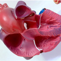 Modelo de corazon trombosis Vascular con arteria