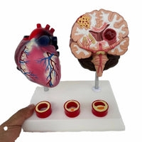 Modelo de corazon trombosis Vascular con Cerebro