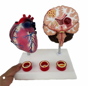 Modelo de corazon trombosis Vascular con Cerebro