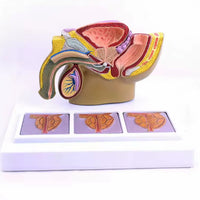 Modelo patológico de Prostata masculino