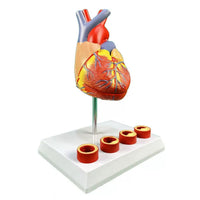 Modelo de anatomía del corazón humano con trombosis