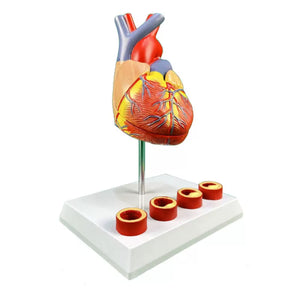 Modelo de anatomía del corazón humano con trombosis