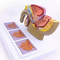 Modelo patológico de Prostata masculino