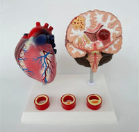 Modelo de corazon trombosis Vascular con Cerebro
