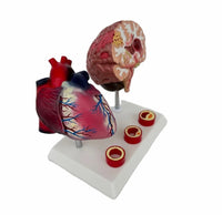 Modelo de corazon trombosis Vascular con Cerebro
