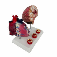 Modelo de corazon trombosis Vascular con Cerebro