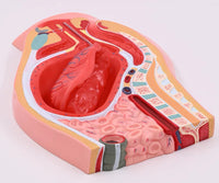 Modelo de desprendimiento separacion de placenta
