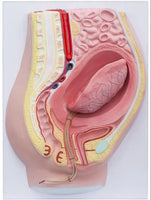 Modelo de desprendimiento separacion de placenta
