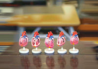 Modelo de malformación cardíaca congénita, simulador de entrenamiento médico de anatomía humana avanzada
