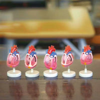 Modelo de malformación cardíaca congénita, simulador de entrenamiento médico de anatomía humana avanzada