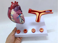 Modelo de corazon trombosis Vascular con arteria
