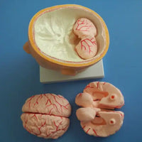 Cabeza con Cerebro Arteria cerebral