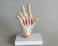 Modelo de Mano artritis reumatoide
