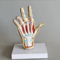 Modelo de Mano artritis reumatoide