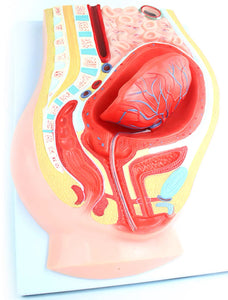 Modelo de desprendimiento separacion de placenta