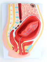 Modelo de desprendimiento separacion de placenta
