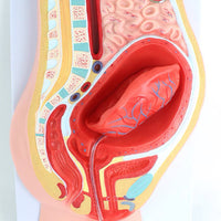 Modelo de desprendimiento separacion de placenta