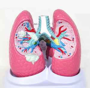 Modelo anatomico comparativo pulmon de fumador