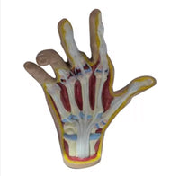Modelo de Mano artritis reumatoide
