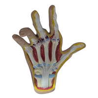 Modelo de Mano artritis reumatoide