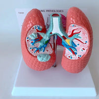 Modelo anatomico comparativo pulmon de fumador