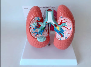 Modelo anatomico comparativo pulmon de fumador