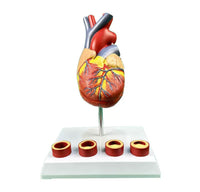 Modelo de anatomía del corazón humano con trombosis
