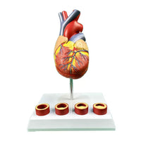 Modelo de anatomía del corazón humano con trombosis