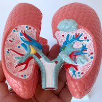 Modelo anatomico comparativo pulmon de fumador