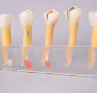 Modelo Dental de 5 etapas para tratamiento endodontico
