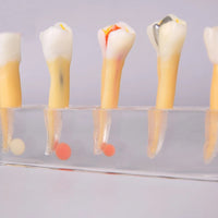 Modelo Dental de 5 etapas para tratamiento endodontico