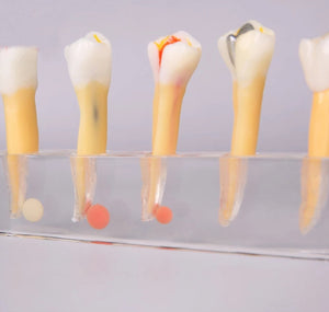 Modelo Dental de 5 etapas para tratamiento endodontico