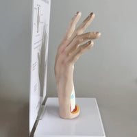 Modelo de Mano artritis reumatoide