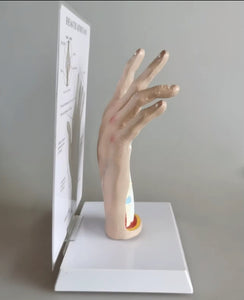 Modelo de Mano artritis reumatoide