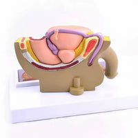 Modelo patológico de Prostata masculino