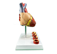 Modelo de anatomía del corazón humano con trombosis
