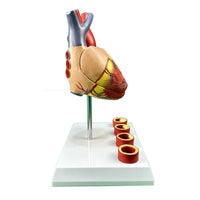 Modelo de anatomía del corazón humano con trombosis