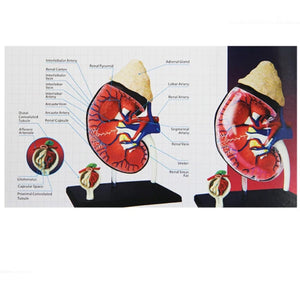 Modelo de riñón humano 4D desmontable