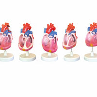 Modelo de malformación cardíaca congénita, simulador de entrenamiento médico de anatomía humana avanzada