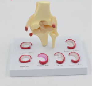 Modelo Anatomico de rodilla -  meniscos traumatologia