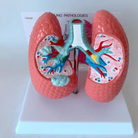 Modelo anatomico comparativo pulmon de fumador