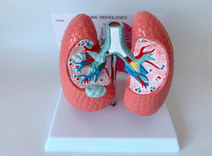 Modelo anatomico comparativo pulmon de fumador