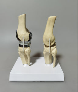 Modelo de Rodilla - menisco ligamento cartílago desmontable