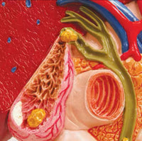 Modelo de cálculos biliares - Alta Simulacion
