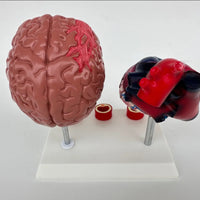 Modelo de corazon trombosis Vascular con Cerebro