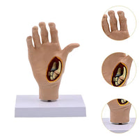 Modelo de Mano patologia tendon y ligamento osteoartritis