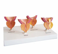 Modelo de prostata y vejiga
