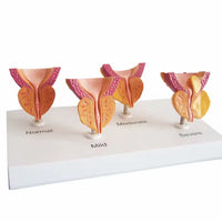 Modelo de prostata y vejiga