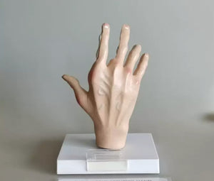 Modelo de Mano artritis reumatoide